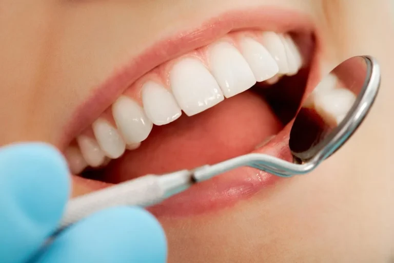 Can you whiten sensitive teeth?